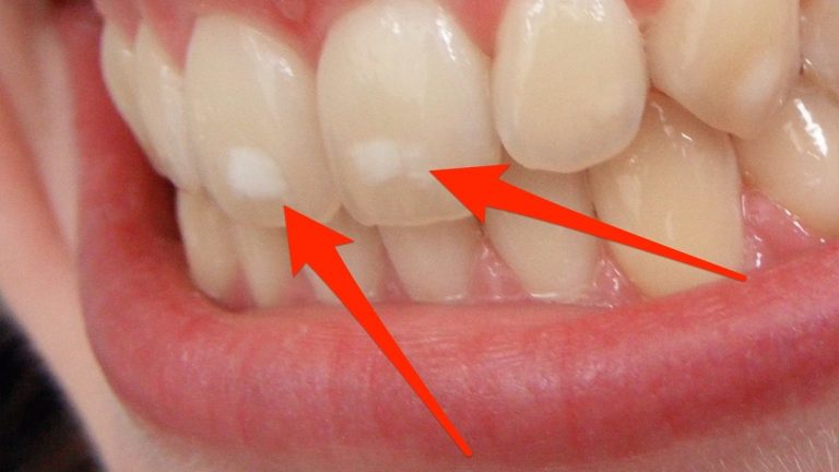 العناية بالأسنان